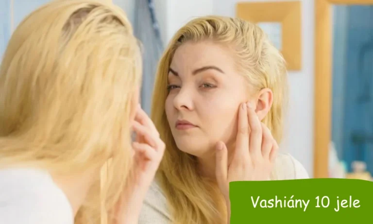 vashiány vashiányra utaló jel